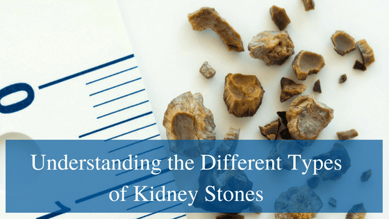 Understanding the Different Types of Kidney Stones